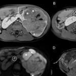 TC y RMN de Abdomen y Pelvis ($ARS)